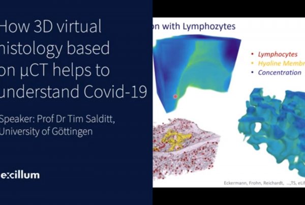 Excillum Covid-19 microCT virtual histology webinar image
